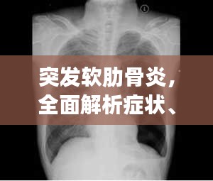 突发软肋骨炎，全面解析症状、预防与治疗策略