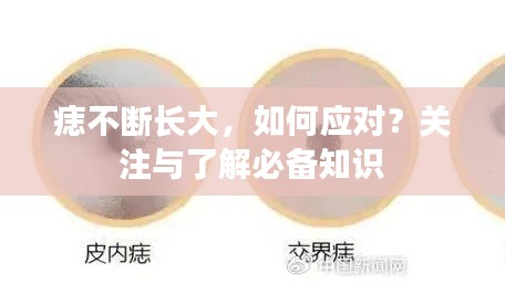 痣不断长大，如何应对？关注与了解必备知识